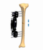 TIBIA 3.1