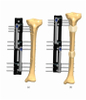TIBIA 4.2