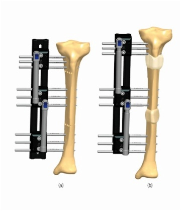 TIBIA 4.2
