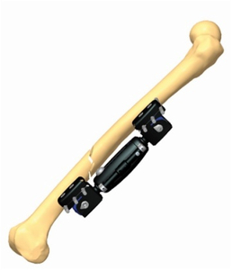 FEMUR 1.3