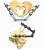 PELVIS 1.1