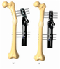 FEMUR 4.1