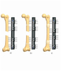FEMUR 6.2