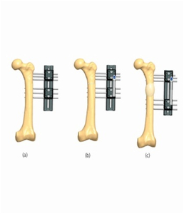 FEMUR 3.1