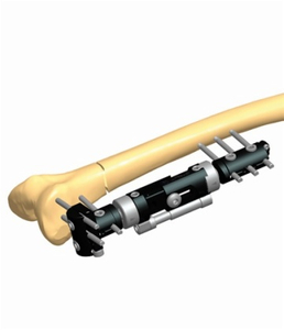 FEMUR 1.6