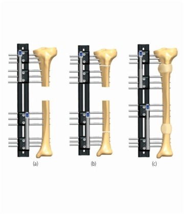 TIBIA 6.2