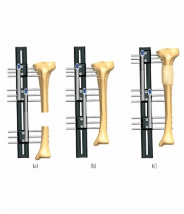 TIBIA 6.4