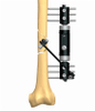 FEMUR 1.4