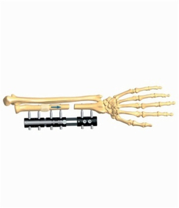 FOREARM 3.2