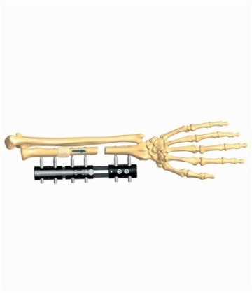 FOREARM 3.2