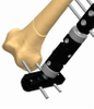 FEMUR 1.8