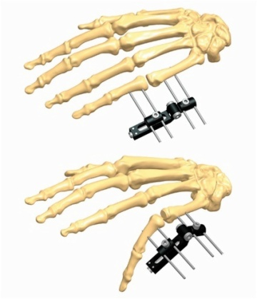 Hand 2.1