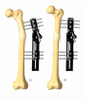 FEMUR 5.1