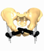 PELVIS 1.2