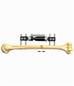 HUMERUS 3.1