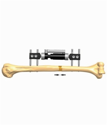 HUMERUS 3.1
