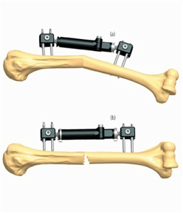 HUMERUS 2.4