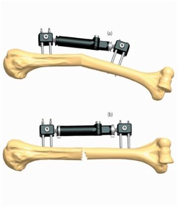 HUMERUS 2.4