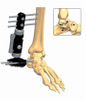 ANKLE 2.1