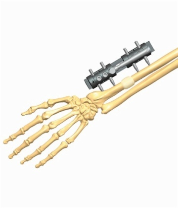 FOREARM 2.2
