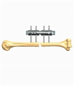 HUMERUS 2.3