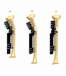 TIBIA 5.1