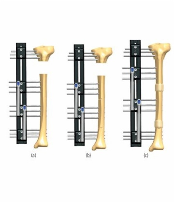 TIBIA 6.3