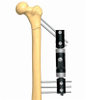 FEMUR 1.2