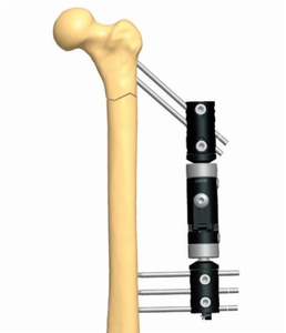 FEMUR 1.2