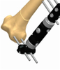 FEMUR 1.7