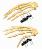 Hand 1.5