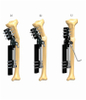 TIBIA 2.1