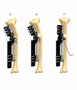 TIBIA 2.1