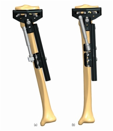 TIBIA 5.2