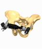 PELVIS 1.3