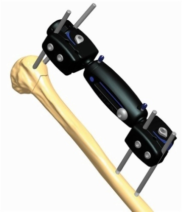 Humerus 1.2