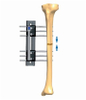 TIBIA 3.2