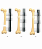 FEMUR 6.1