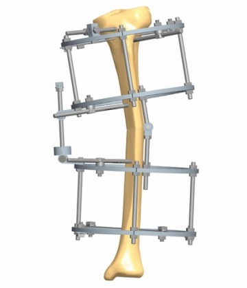 TIBIA 2.5