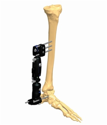  ANKLE 1.4