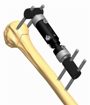 Humerus 1.1