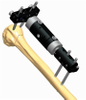 HUMERUS 1.3
