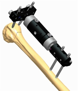 HUMERUS 1.3