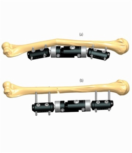 HUMERUS 2.2