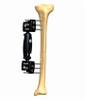 TIBIA 1.5