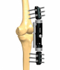 KNEE 2.2
