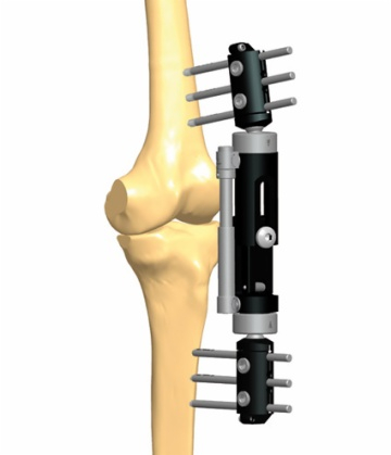 KNEE 2.2
