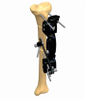 TIBIA 1.7
