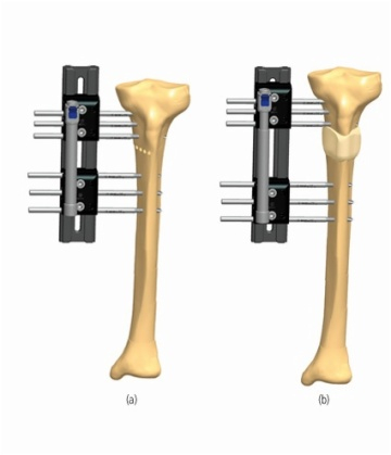  TIBIA 4.1