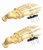 FOOT 1.4